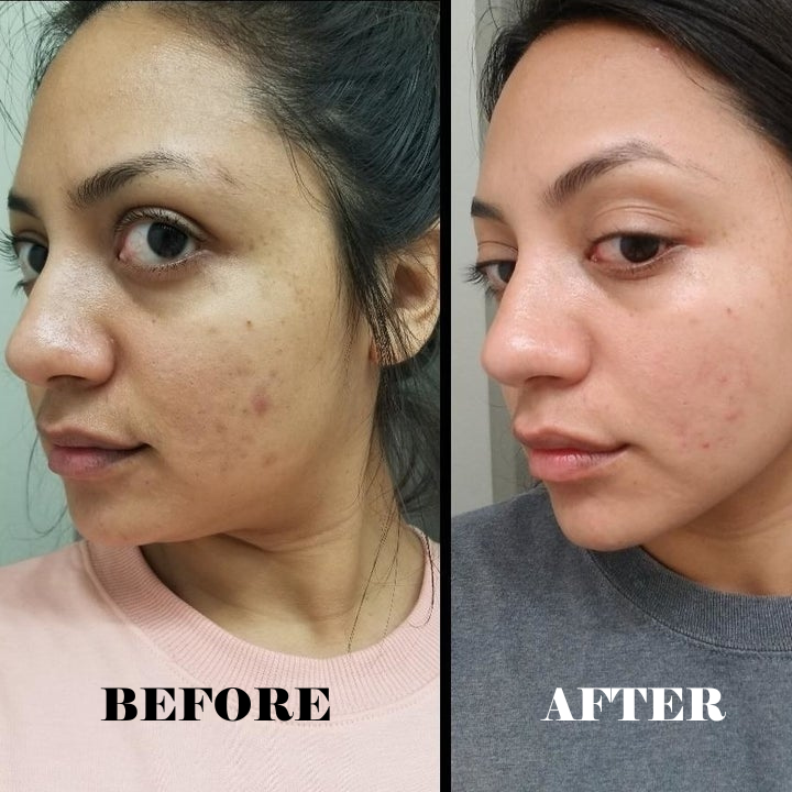 what is the meaning of glutathione Glutathione- The Ultimate Antioxidant — Purifi IV what is the meaning of glutathione Glutathione- The Ultimate Antioxidant — Purifi IV