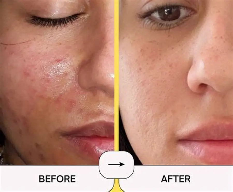 Advanced Brightening Serum with Glutathione, Vitamin C and Niacinamide Glissen Care Advanced Brightening Serum with Glutathione, Vitamin C and Niacinamide Glissen Care